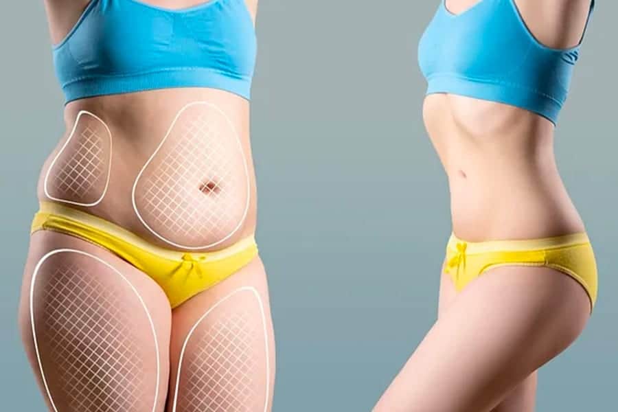 Bodylift : l’opération du engendre-t-elle une douleur ?